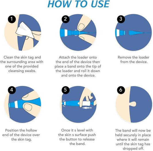2-in-1 Skin Tag Remover Kit – Painless & Safe for All Skin Types - Catalyst Mart