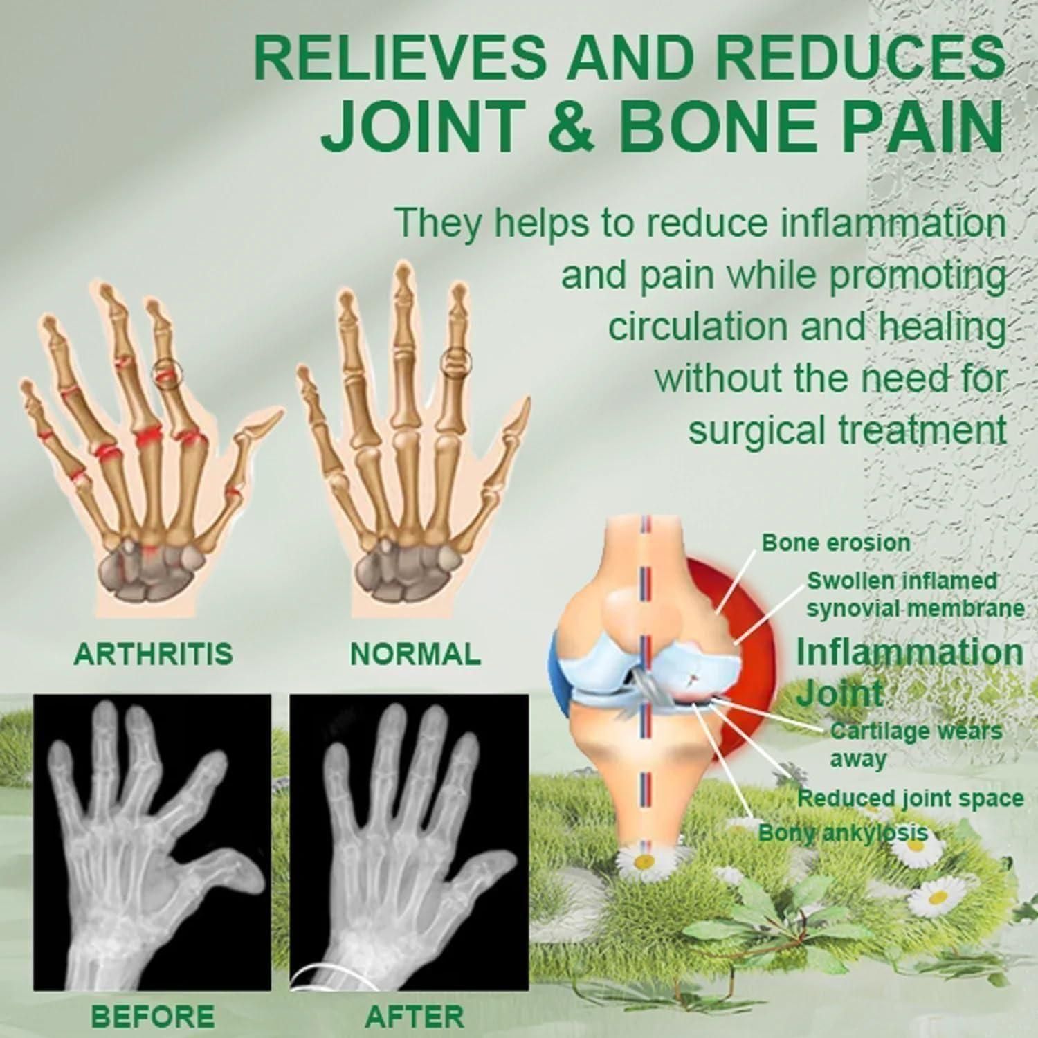 Bee Venom Joint and Bone Therapy Cream (Pack of 3) - Catalyst Mart