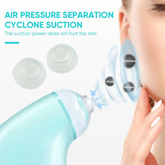 Mini Vacuum Blackhead Remover – Spot Reducer, Skin Lifting Massager & Facial Pore Cleaner for Men & Women (1 Pc) - Catalyst Mart